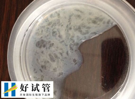 C级精子做试管的成功率并不能一概而论