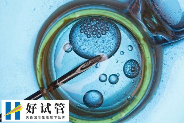 amh值通常与年龄成反比关系