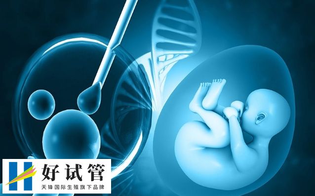 试管专家